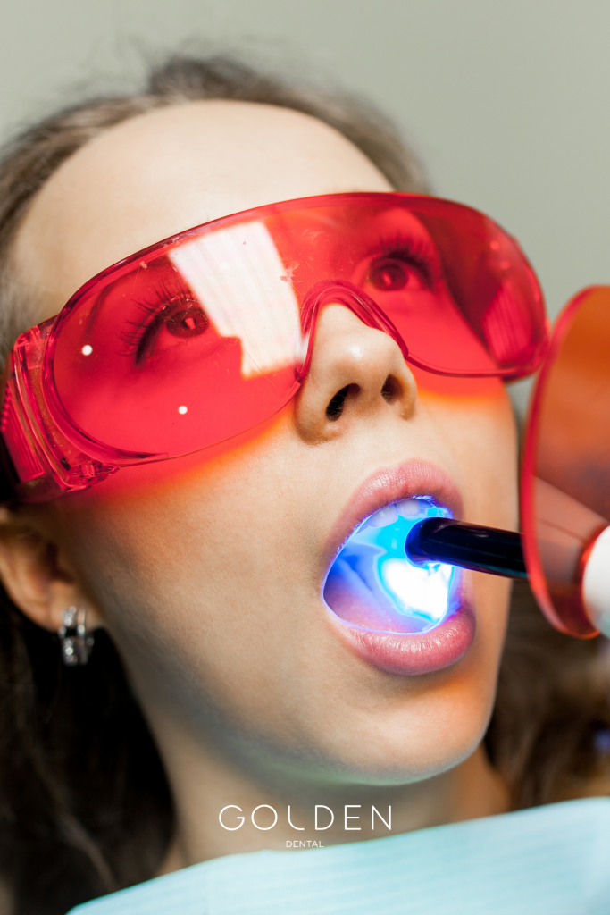 blanqueamiento dental