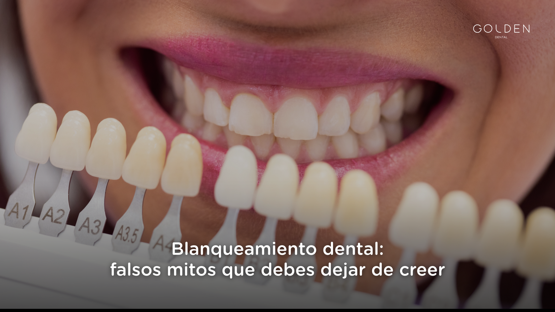 Mitos Blanqueamiento dental
