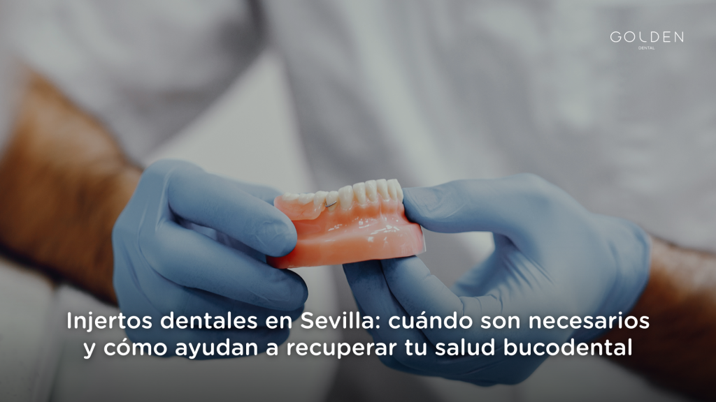 injertos dentales Sevilla