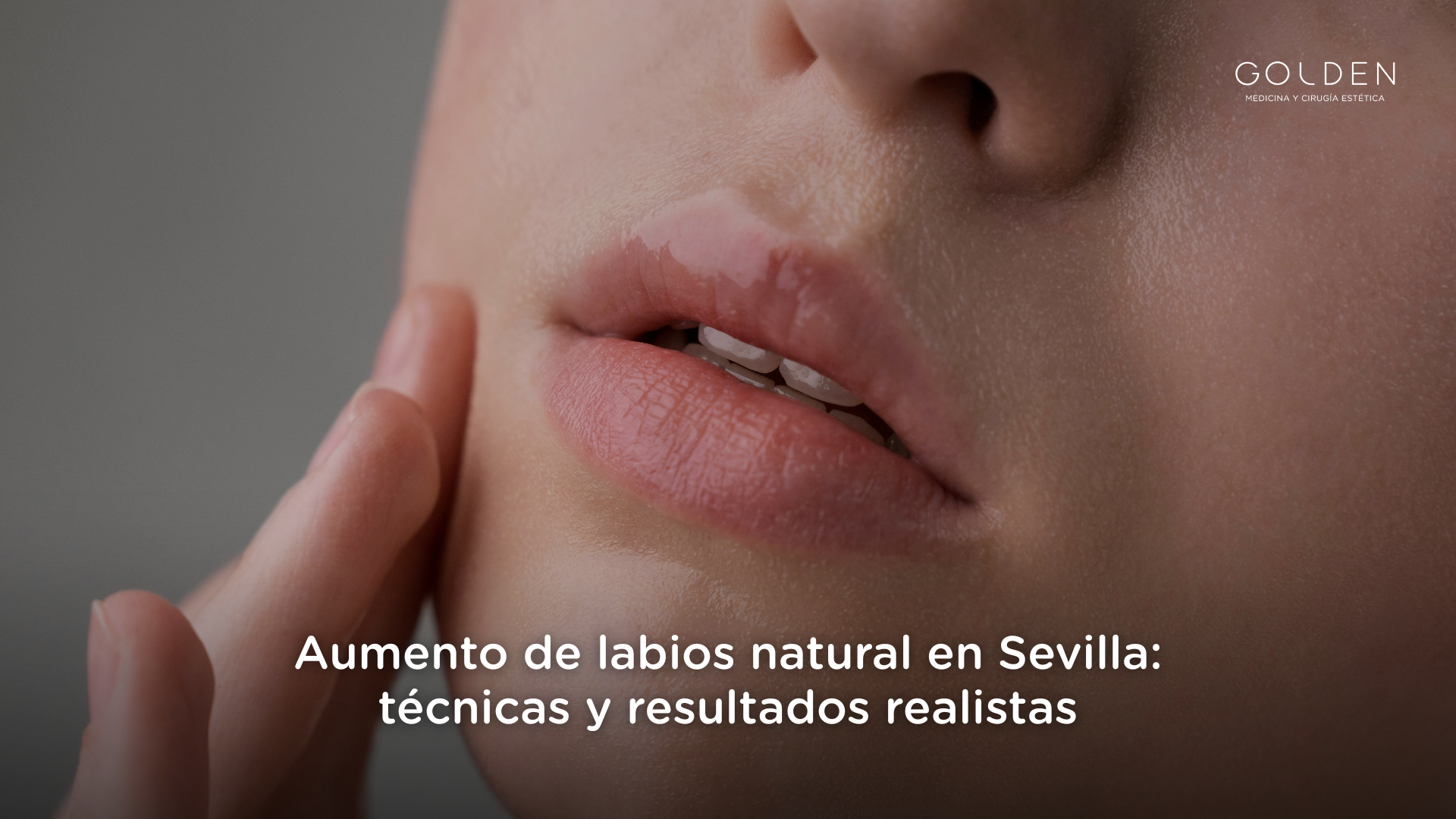 aumento de labios natural en Sevilla