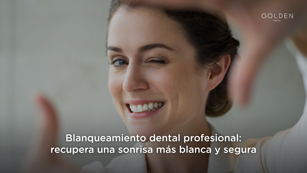 blanqueamiento dental profesional