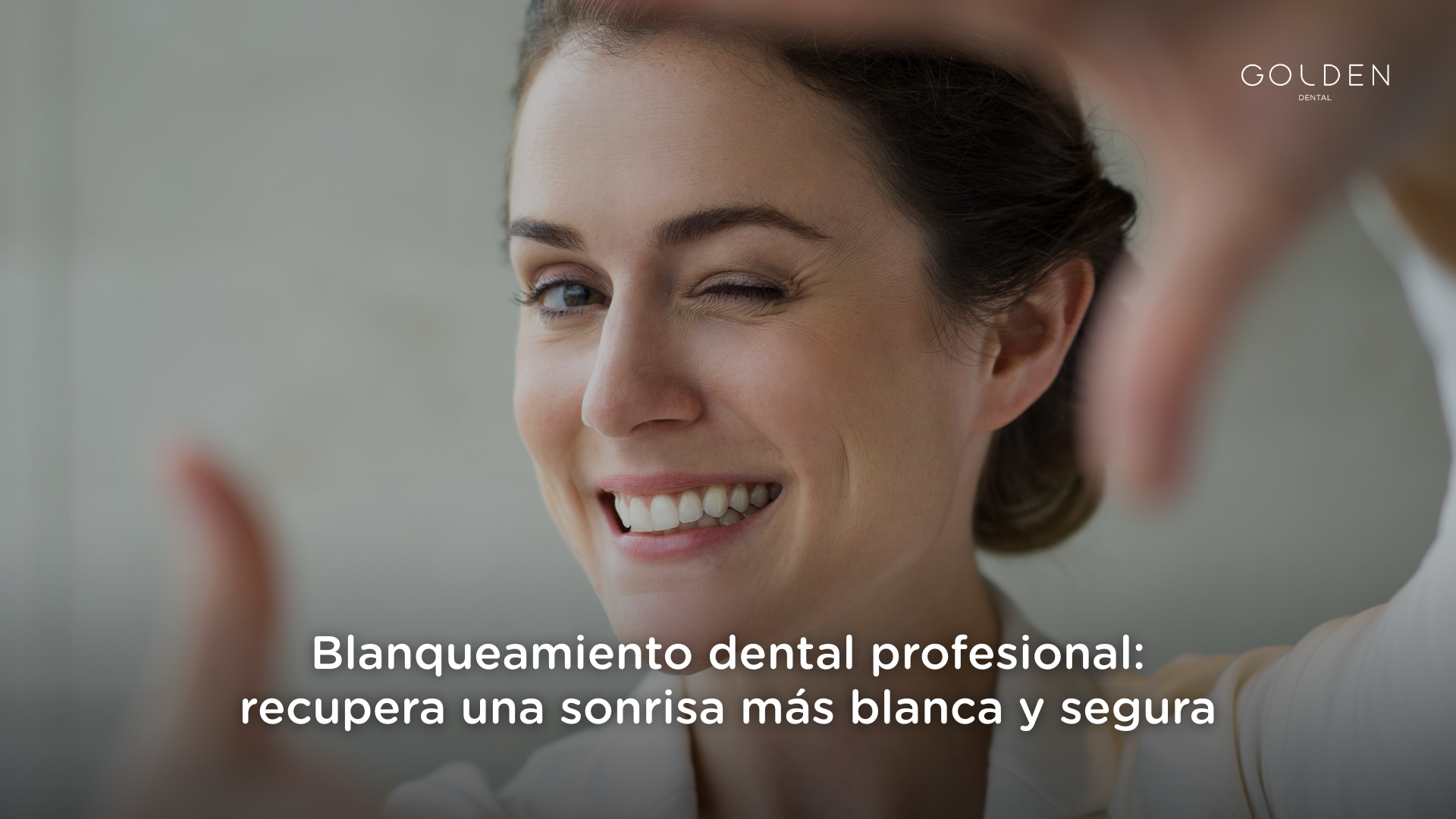 blanqueamiento dental profesional
