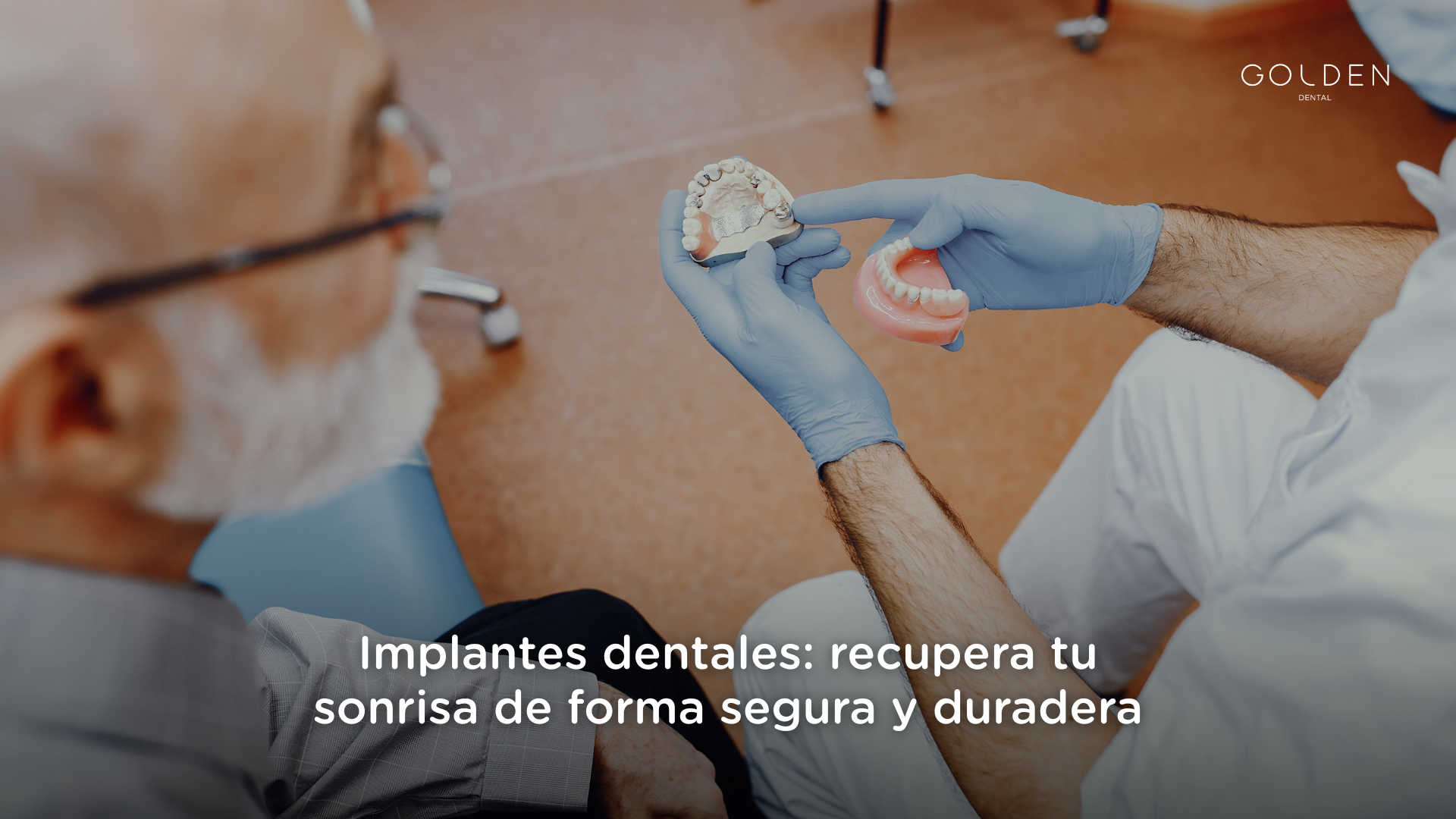 implantes dentales
