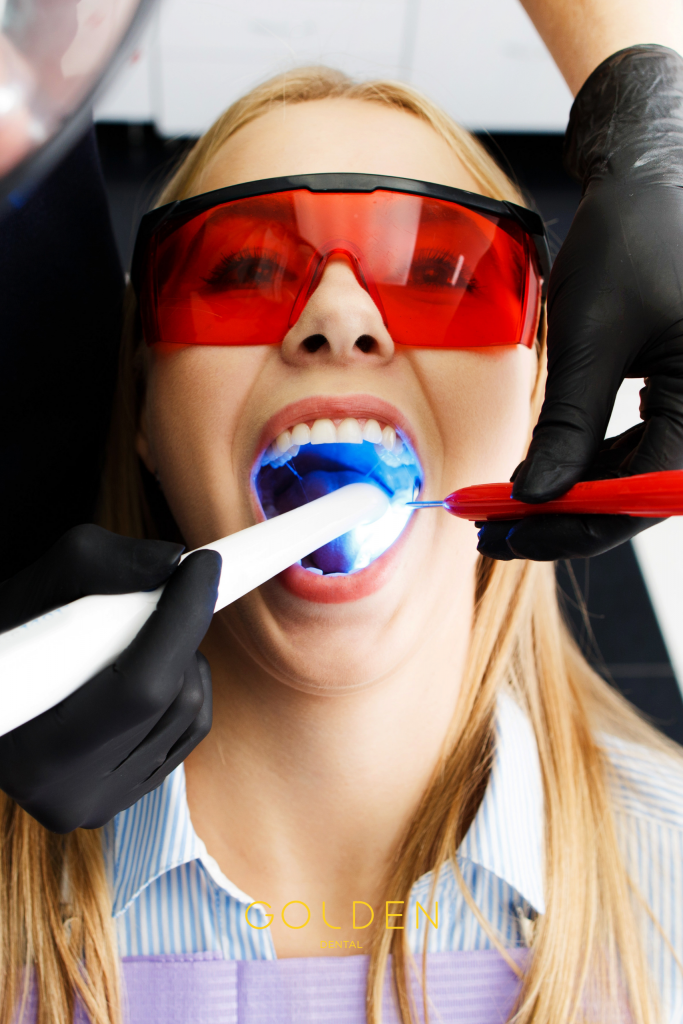 limpieza dental profesional