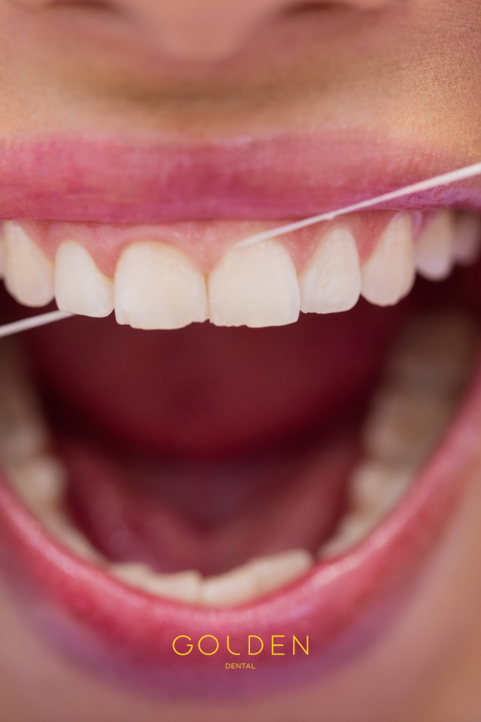 limpieza dental profesional