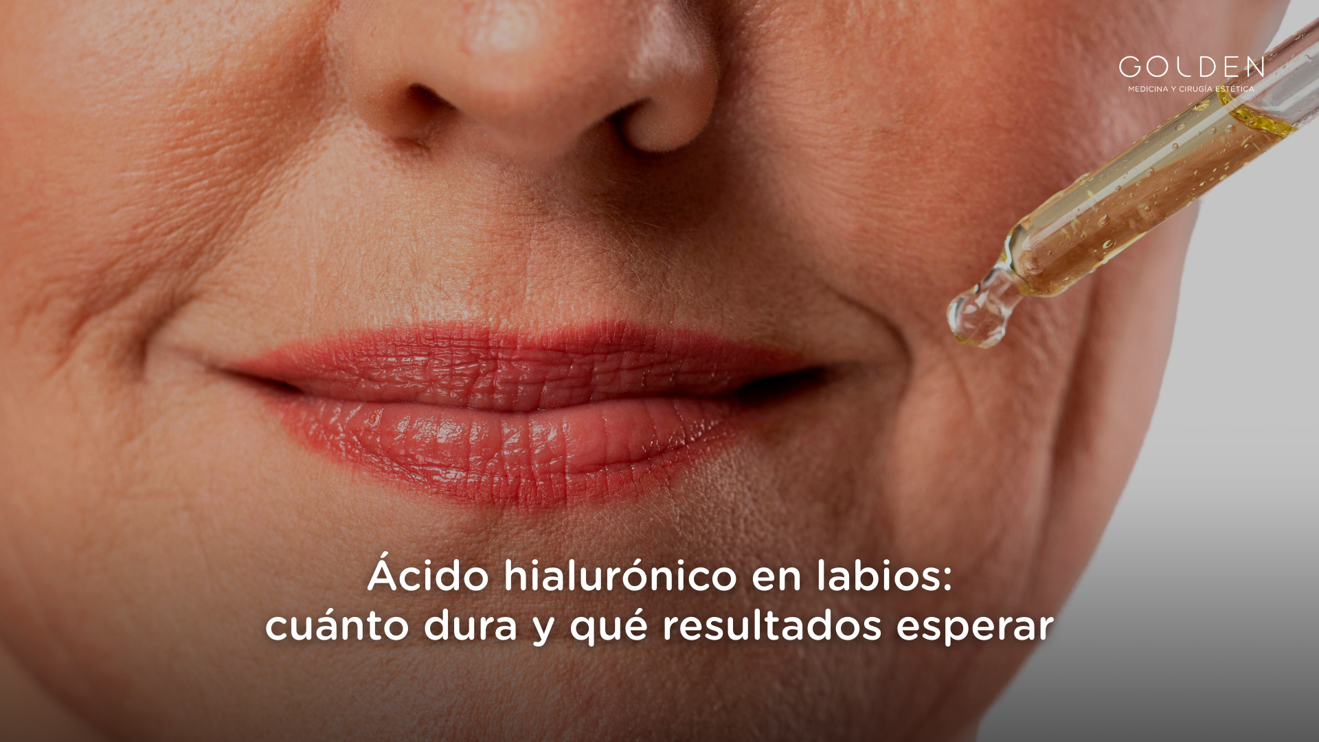 ácido hialurónico labios