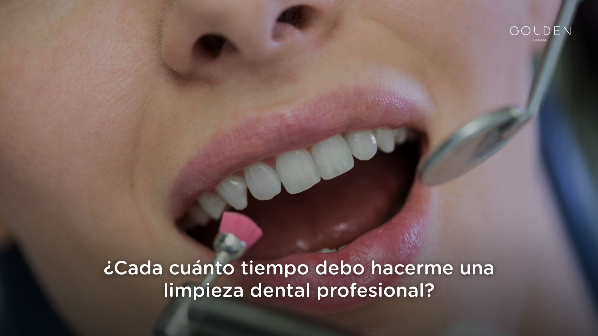 limpieza dental profesional