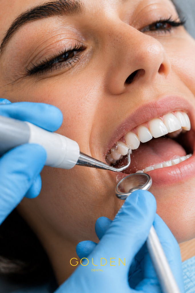 limpieza dental en Sevilla