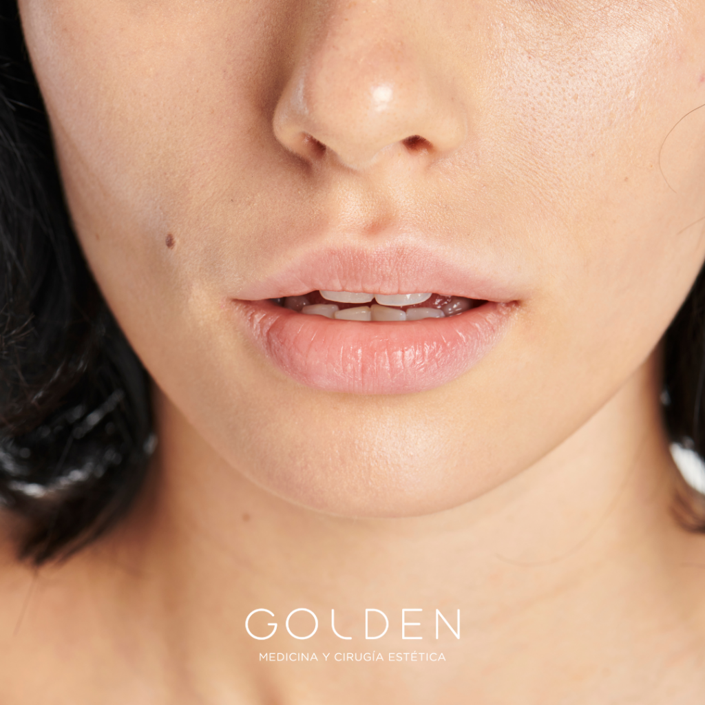 ácido hialurónico en Sevilla