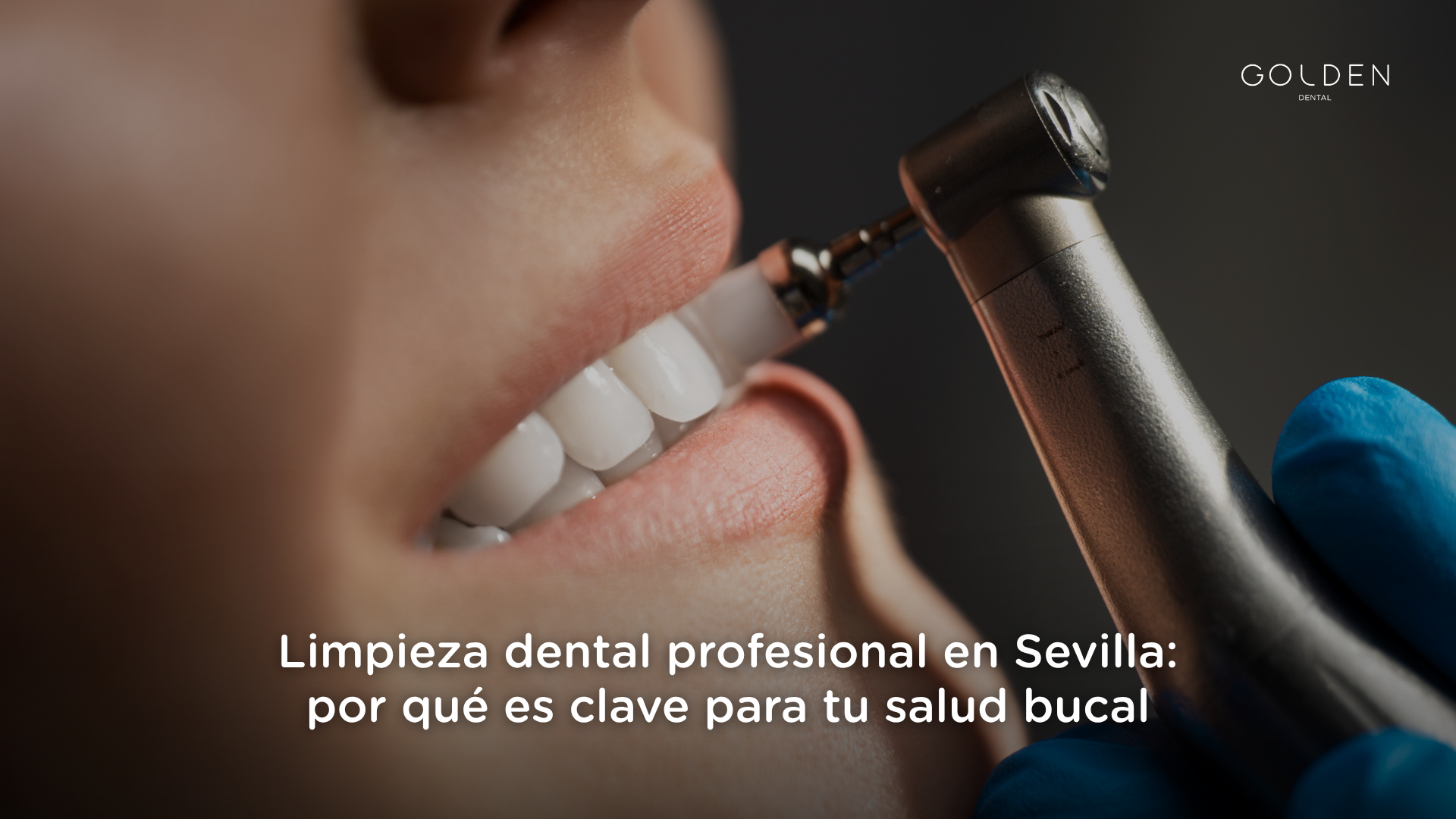 limpieza dental Sevilla
